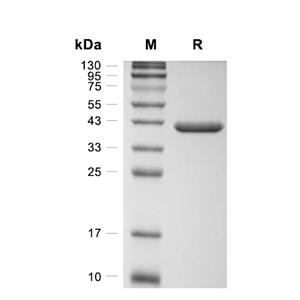 Pepsinogen C/PGC蛋白, Rat (HEK293, His)
