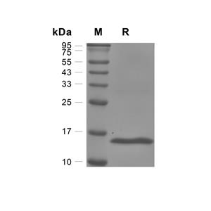 REG-3 delta/REG3D蛋白, Mouse (HEK293, His)