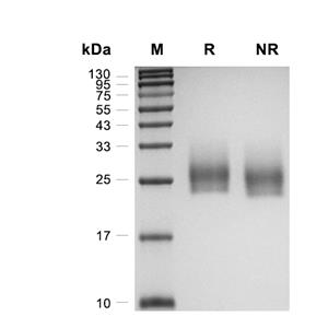 SCN3B蛋白, Human (HEK293, His)