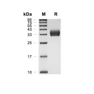 IL-2R beta/CD122蛋白, Rhesus Macaque (HEK293, His)