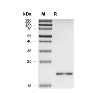 COPZ1蛋白, Human/Mouse/Rat (His)