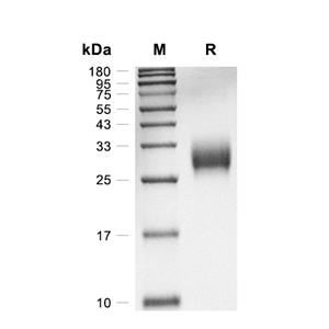 CPLX3蛋白, Human (HEK293, His),CPLX3 Protein, Human (HEK293, His)