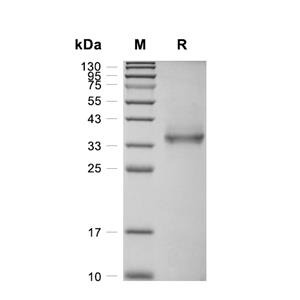 CSAG1蛋白, Human (HEK293, Fc)