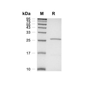CTRB1蛋白, Rat (HEK293, His)