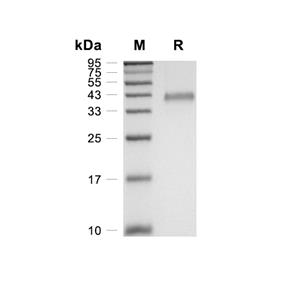 CXCL7蛋白, Cynomolgus/Rhesus Macaque (HEK293, Fc)