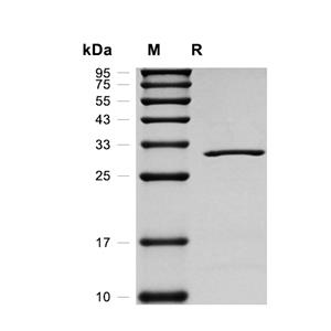 CYB5R1蛋白, Human (His)