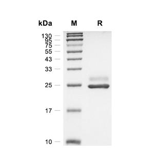 FKBP14蛋白, Human (HEK293, His)