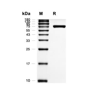 CD316/IGSF8蛋白, Mouse (HEK293, His)