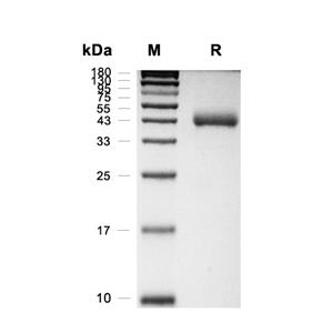 KIR3DL3/CD158z蛋白, Human (HEK293, His)
