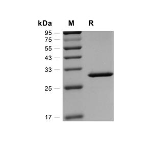 NCKIPSD蛋白, Human (His)