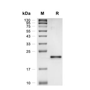 DUSP14蛋白, Human (His)