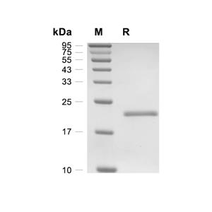 CARHSP1蛋白, Human (His)