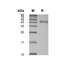 Cystatin-8/CST8蛋白, Human (HEK293, Fc)
