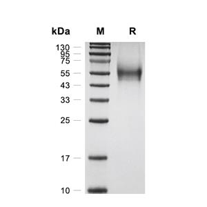 Draxin蛋白, Human (HEK293, His),Draxin Protein, Human (HEK293, His)