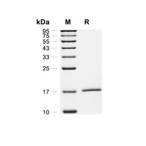 FUOM/Fucose Mutarotase蛋白, Human (His)