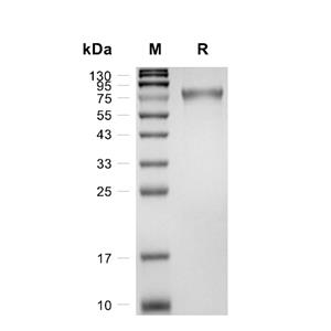 GFRA2/GDNFR-alpha-2蛋白, Mouse (HEK293, His),GFRA2/GDNFR-alpha-2 Protein, Mouse (HEK293, His)
