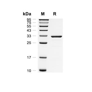 HAAO蛋白, Rat (His)
