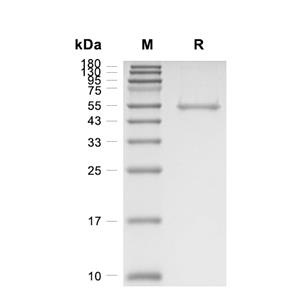 TAOK3蛋白, Human (sf9, His)