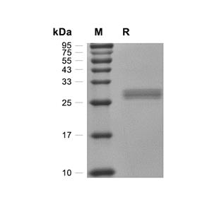 TMED1蛋白, Human (HEK293, His)