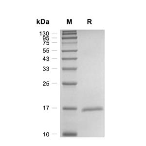 IL-20蛋白, Mouse (HEK293, His)