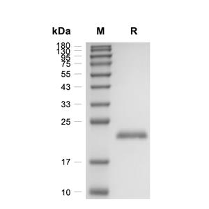 KGF/FGF-7蛋白, Human (Biotinylated, His)