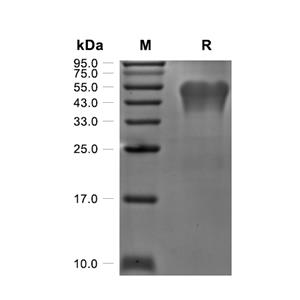 GPVI蛋白, Human (HEK293, His)