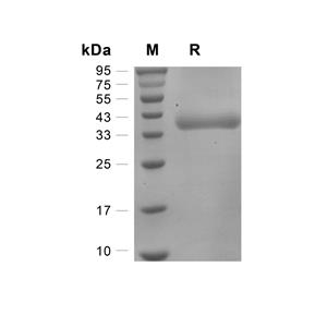 Prostasin/PRSS8蛋白, Human (HEK293, His),Prostasin/PRSS8 Protein, Human (HEK293, His)