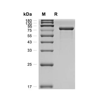 Serpin D1蛋白, Human (HEK293, His)