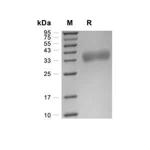 Fc gamma RIII/CD16蛋白, Rhesus Macaque (HEK293, His)