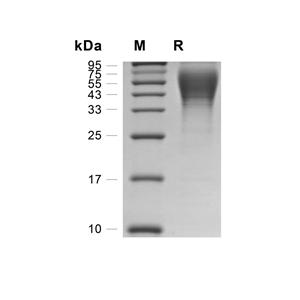 CD200R4蛋白, Mouse (HEK293, His)