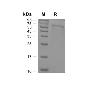 ADAM8蛋白, Rhesus Macaque (HEK293, His),ADAM8 Protein, Rhesus Macaque (HEK293, His)
