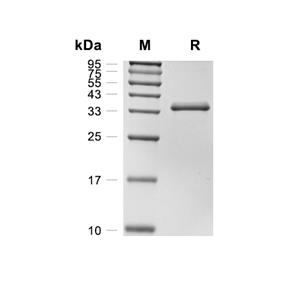 DEFB127蛋白, Human (HEK293, Fc),DEFB127 Protein, Human (HEK293, Fc)