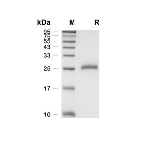 EDA2R/XEDAR蛋白, Cynomolgus (HEK293, His)