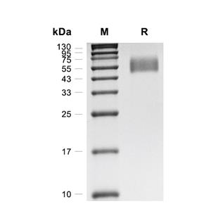 IL-13R alpha 1蛋白, Cynomolgus (HEK293, His),IL-13R alpha 1 Protein, Cynomolgus (HEK293, His)