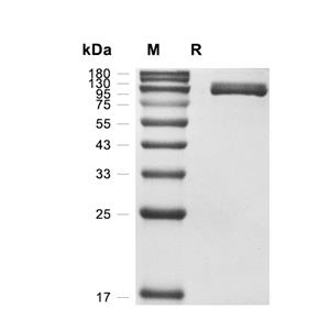 NAALADL1蛋白, Human (HEK293, His)