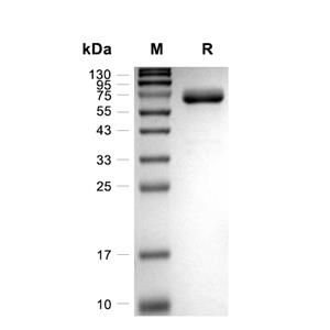 EphB1蛋白, Rhesus Macaque (HEK293, His)