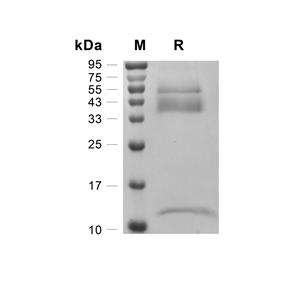 Latent TGF beta 1/TGFB1蛋白, Mouse (HEK293, His)