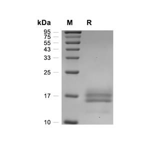 IL-5蛋白, Rabbit (HEK293, His),IL-5 Protein, Rabbit (HEK293, His)