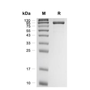 FAP蛋白, Rat (HEK293, His)