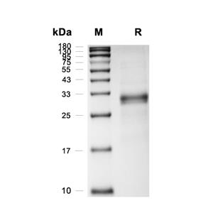 FGF-23蛋白, Human (R179Q, HEK293, His)