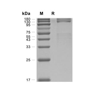 IGF-I R蛋白, Mouse (HEK293, His)