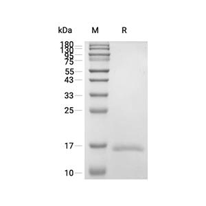 FABP1/L-FABP蛋白, Human (His, solution)