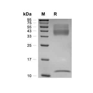 Latent TGF beta 1/TGFB1蛋白, Cynomolgus (C33S, HEK293, His)