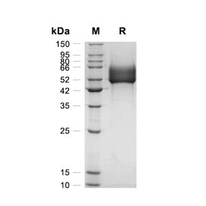 DKK-3蛋白, Human (R335G, HEK293, His)