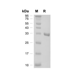 Syntenin-1蛋白, Human (N-His)
