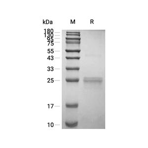 PPC-DC蛋白, Human (His, solution)