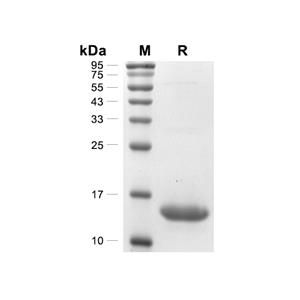 ACPS蛋白, Streptococcus pyogenes serotype M28 (His)