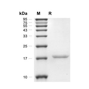 Leptin蛋白, Rat (His),Leptin Protein, Rat (His)