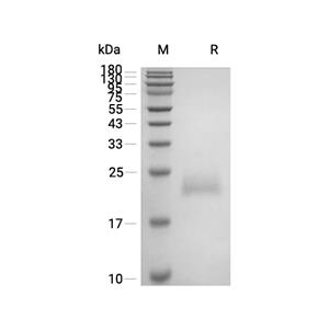 RSPO1/R-spondin-1蛋白, Human (125a.a, HEK293, His)