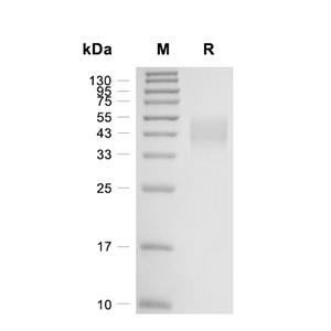 TROP-2蛋白, Rat (246a.a, HEK293, His)